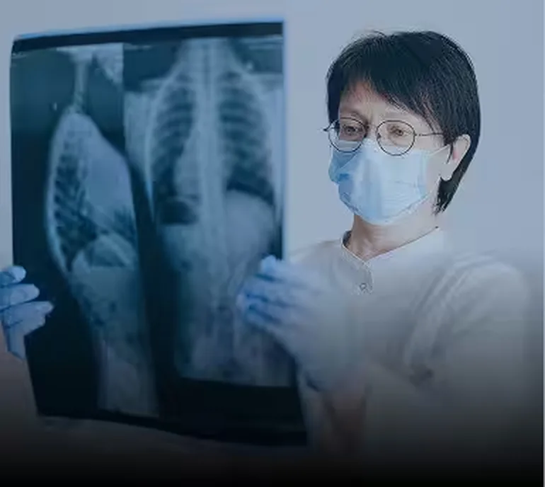Physician reviewing X-rays of a car accident injury